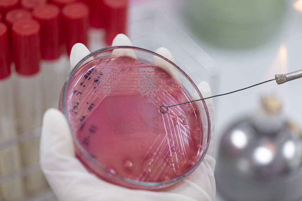 antimicrobial resistance, culture, lab