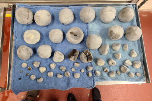 enteroliths