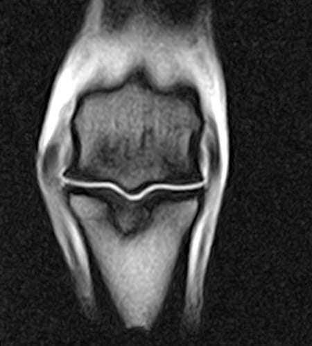 long pastern bone damage in sport horses