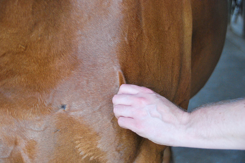 skin pinch test for dehydration