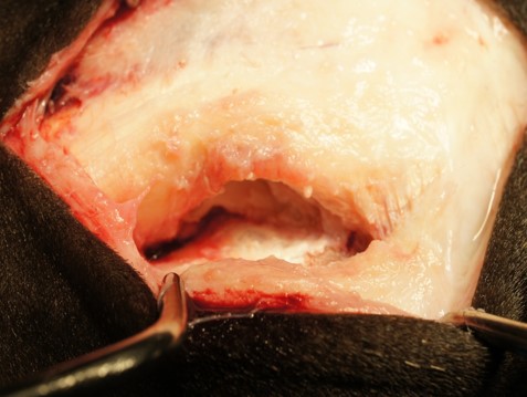 suspensory ligament branch tears