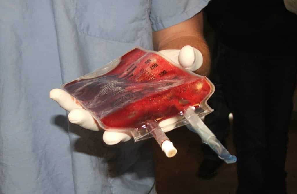 Stem Cells in Bag