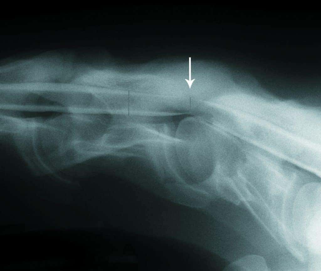 Where are we Headed with Wobbler Syndrome?